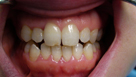 Caso di igiene dentale dopo